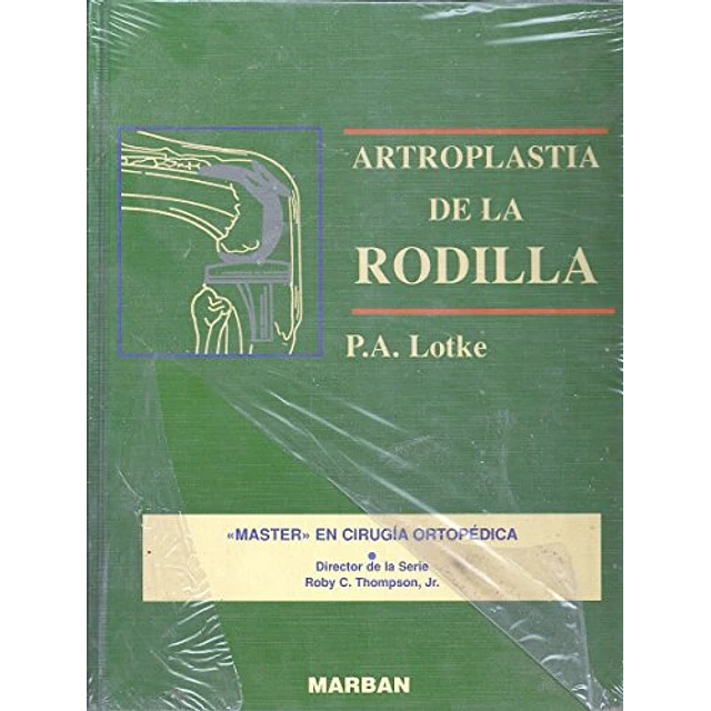 Artroplastia de la rodilla : master en cirugia ortopedica