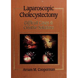 Laparoscopic Cholecystectomy