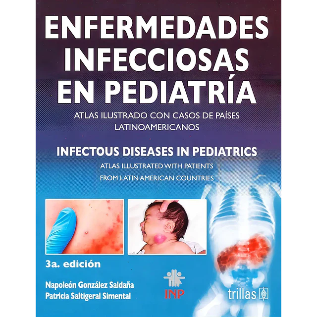 Enfermedades Infecciosas en Pediatría
