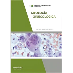 Citología Ginecológica