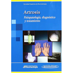 Artrosis