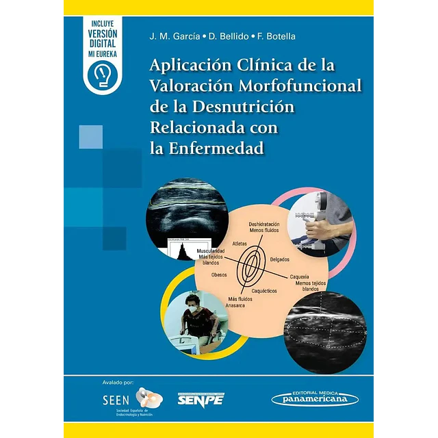 Aplicación clínica de la valoración morfofuncional de la desnutrición relacionada con la enfermedad
