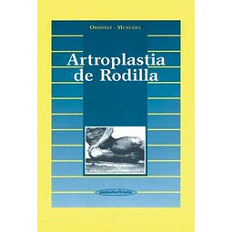 Artroplastia de la rodilla