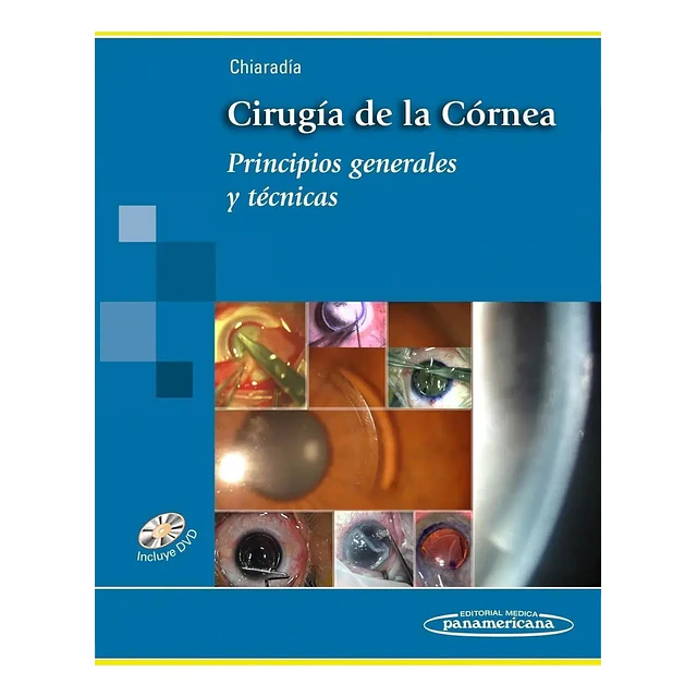 Cirugía de la Córnea