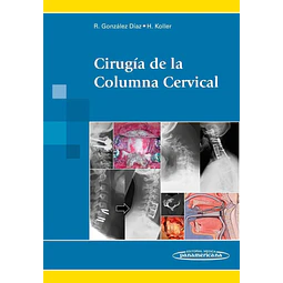 Cirugía de la Columna Cervical