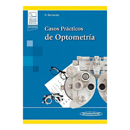 Casos prácticos de optometría