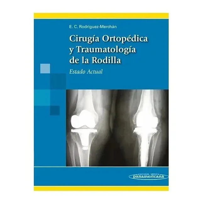 Cirugía Ortopédica y Traumatología de la rodilla