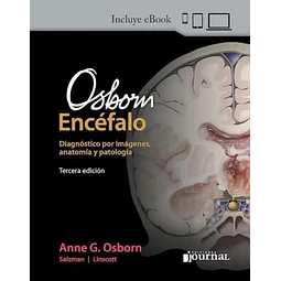 OSBORN Encéfalo. Diagnóstico por imágenes, anatomía y patología