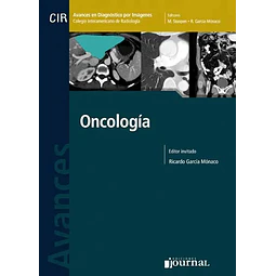 Oncología