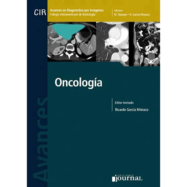 Oncología