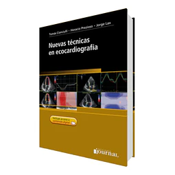 Nuevas técnicas en ecocargrafía