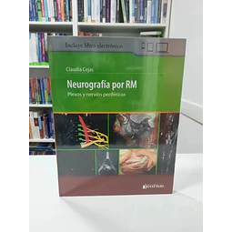 Neurografía por RM