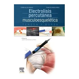 Electrolisis percutánea musculoesquelética. Tendón y bursa