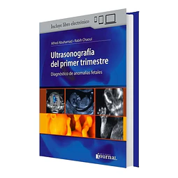 Ultrasonografía del primer trimestre