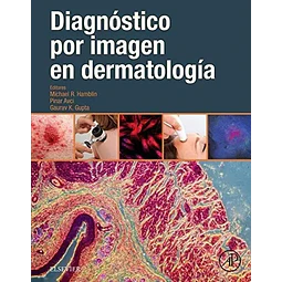 Diagnóstico por imagen en dermatología