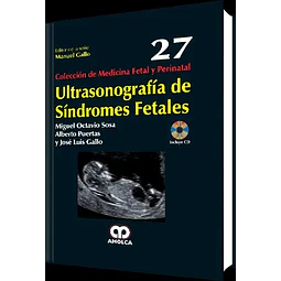 Ultrasonografía de Síndromes Fetales 27