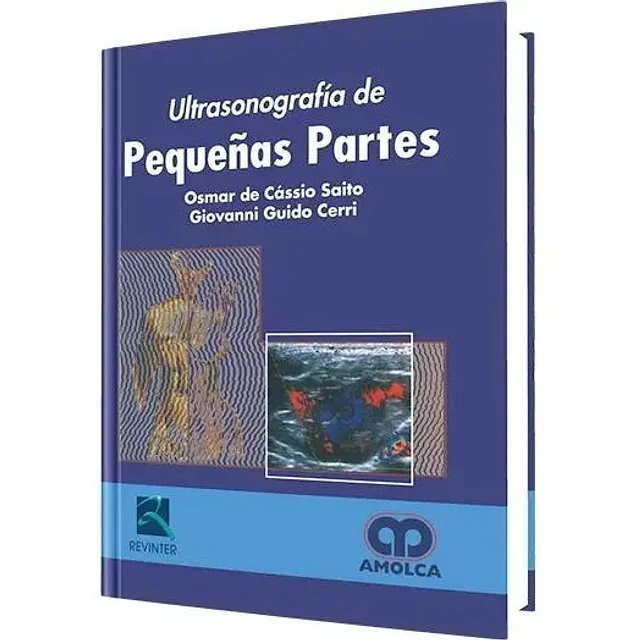 Ultrasonografía de Pequeñas Partes