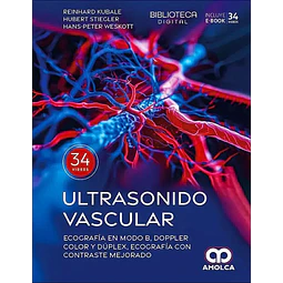 Ultrasonido vascular. Ecografía en Modo B, Doppler color y dúplex, ecografía con contraste mejorado