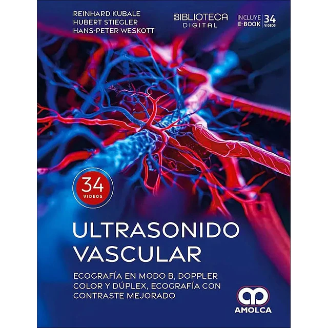 Ultrasonido vascular. Ecografía en Modo B, Doppler color y dúplex, ecografía con contraste mejorado