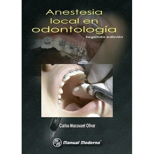 Anestesia local en odontologia