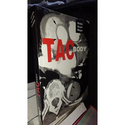 TAC Body