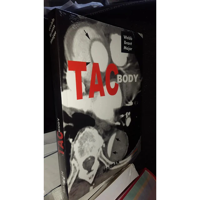 TAC Body