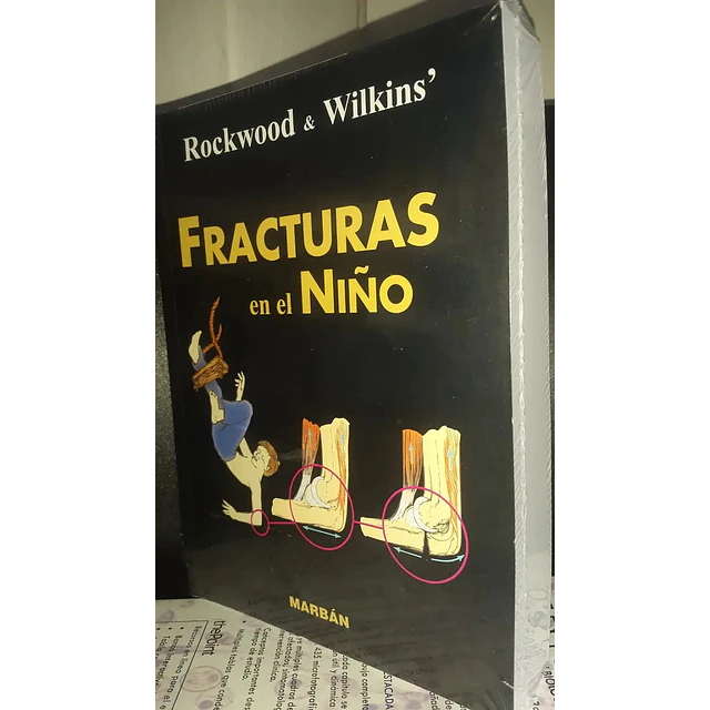 Rockwood y Wilkins Fracturas en el Niño