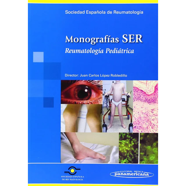 Monografías SER Reumatología Pediátrica