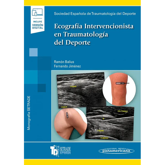 Ecografía Intervencionista en Traumatología y Deporte