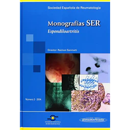 Monografías SER Espondiloartritis
