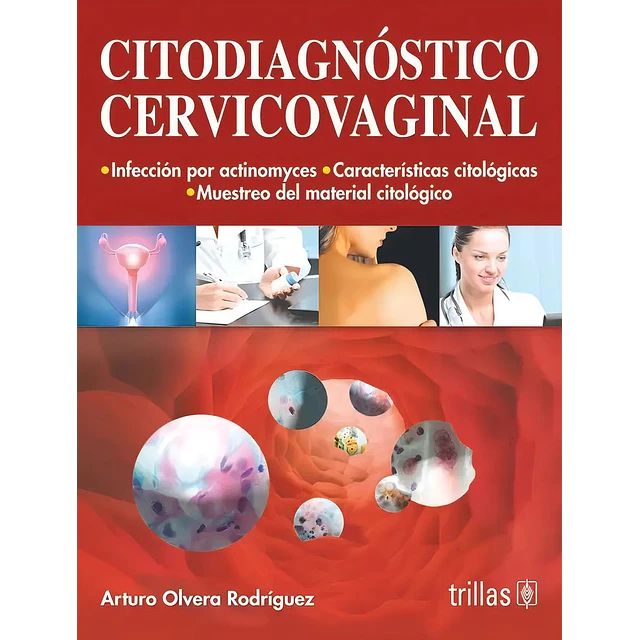 Citodiagnóstico Cervicovaginal