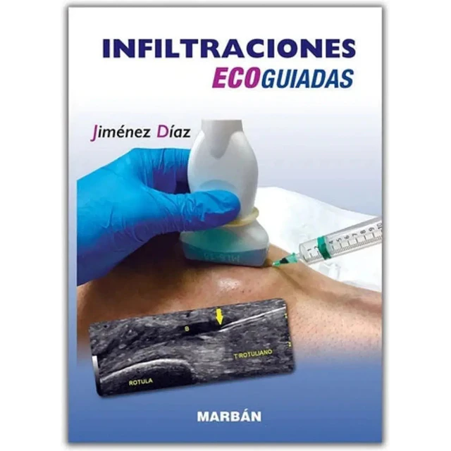 Infiltraciones ECOGUIADAS