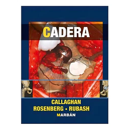 Cadera Callaghan