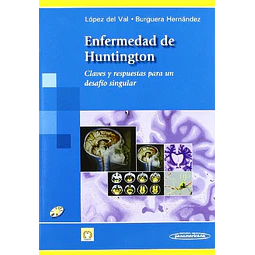 Enfermedad de Huntington