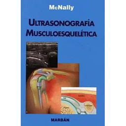 Ultrasonografía Musculoesquelética