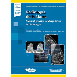 Radiología de la mama.