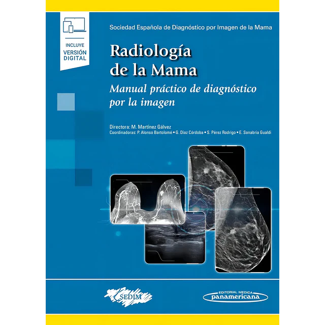 Radiología de la mama.