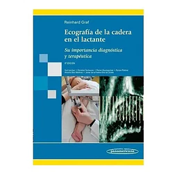 Ecografía de la cadera en el lactante
