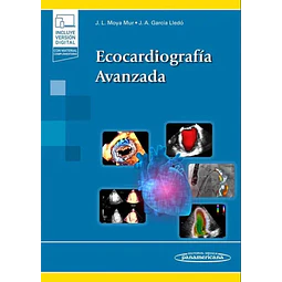 Ecocardiografía avanzada
