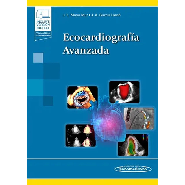 Ecocardiografía avanzada