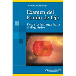 Examen de Fondo de Ojo