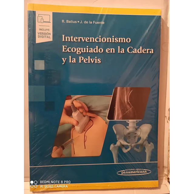Intervencionismo Ecoguiado en la Cadera y la Pelvis