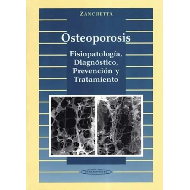 Osteoporosis