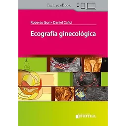 Ecografía ginecológica