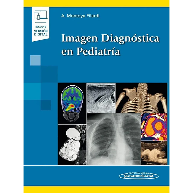 Imagen Diagnóstica en Pediatría