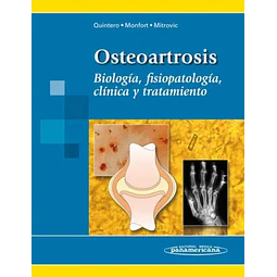 Osteoartrosis