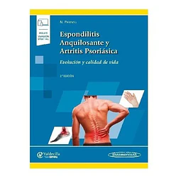 Espondilitis Anquilosante y Artritis Psoriásica