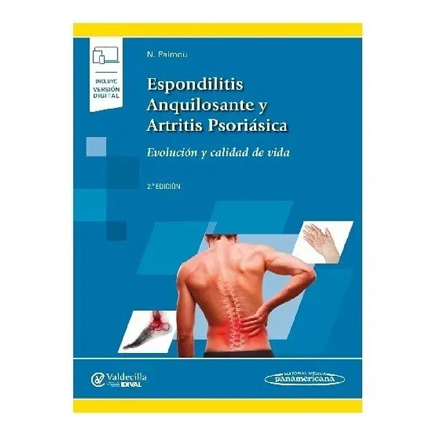 Espondilitis Anquilosante y Artritis Psoriásica