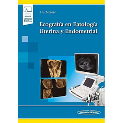 Ecografía en Patología Uterina y Endometrial