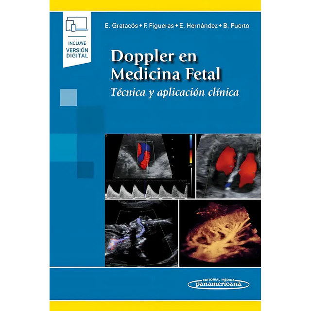 Doppler en Medicina Fetal